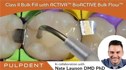 Class II Restoration with ACTIVA™ BioACTIVE Bulk Flow™ presented by Dr. Nate Lawson