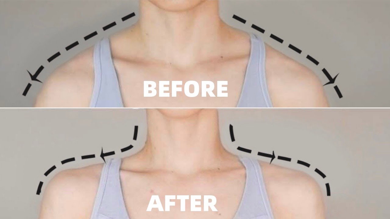Get Beautiful Neck and Shoulders in 14 DAYS | Fix Posture and Relieve Pain!