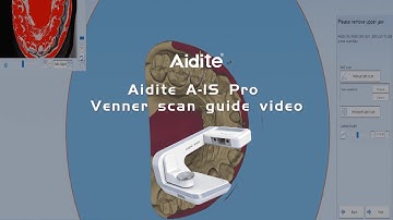 Aidite A IS Pro Venner scan guide video