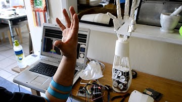 Open/Close using AI Recognition
