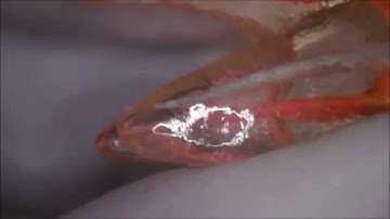 New endodontic Single file: Neoniti by Neolix.