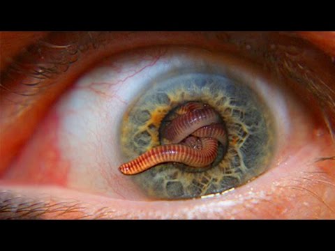 Vidéo: 5 Vers Parasites Qui Peuvent Vivre Chez Les Humains