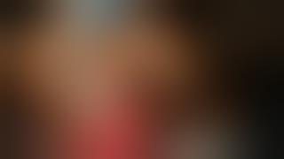 Minimally Invasive Cardiac Surgery (MICS), Coronary Artery Bypass Graft (CABG)