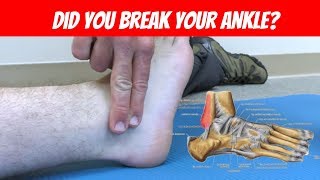 Ankle Sprain or Fracture? - Ottawa Ankle Rules screenshot 1