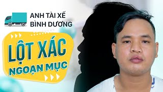 Anh Tài Xế Bình Dương "Lột Xác" Ngoạn Mục Sau 30 Ngày Phẫu Thuật Sứt Môi Hờ Hàm Ếch