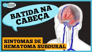 HEMATOMA SUBDURAL CRÔNICO: 9 fatos que você precisa saber