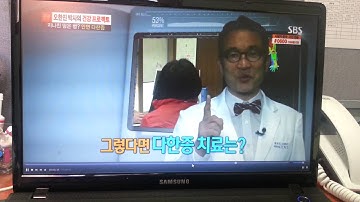 바르는 안면땀치료