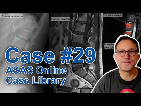 Videó: Az O.A.S.E. Orvosi Könyvtár Düsseldorfban, Németország