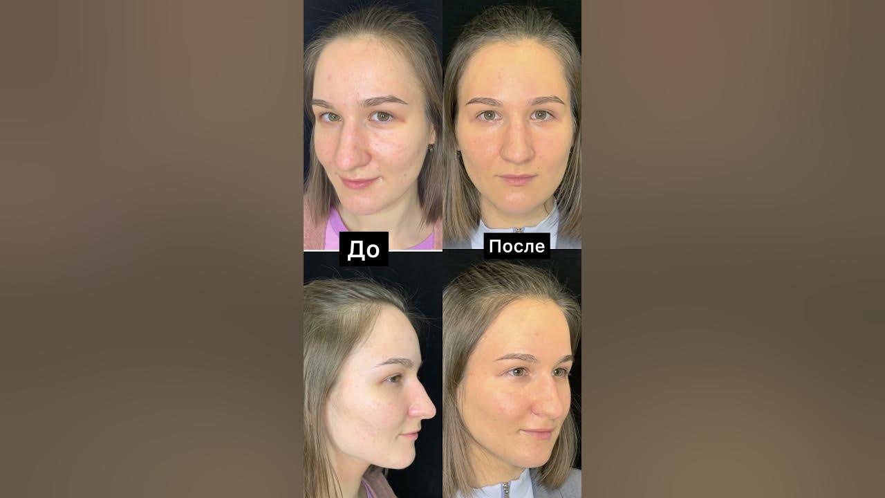 Преображение анны сивковой. Преображение анны. Преображение анны. Преображение анны. Анна преображенская.