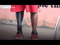 3D-printed limbs revolutionizing prosthetics in Kenya