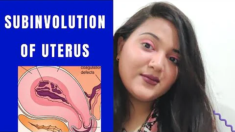 SUBINVOLUTION OF UTERUS || EXPLANATION IN HINDI || FOR MEDICAL STUDENTS - DayDayNews