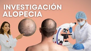Últimos Tratamientos En Alopecia Androgenética