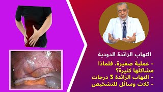 التهاب الزائدة الدودية: د  علي بطيخ يشرح كل المعلومات الصحيحة عن الزائدة وأعراضها وعملياتها