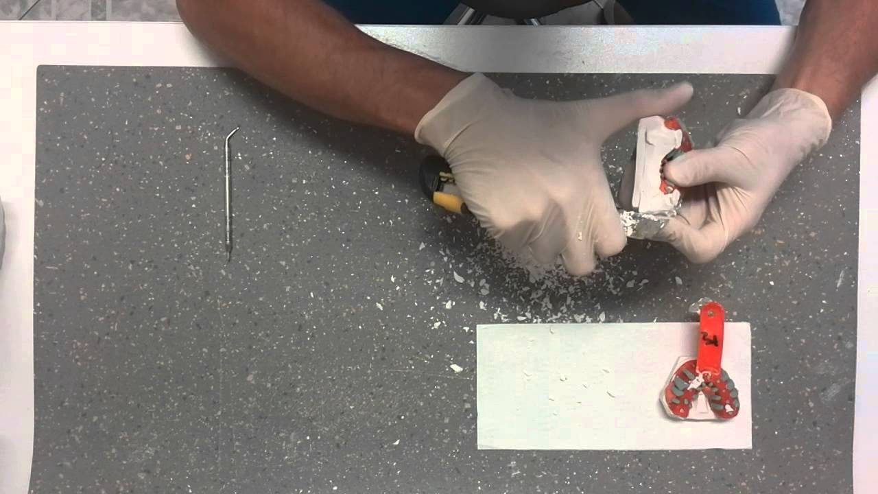 Lucrări modele  de studiu dinții - Tehnician pe talent mâna 👈🏻😉✋🏻🤚🏻