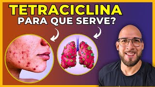 TETRACICLINA - Para que serve? Efeitos colaterais? Como funciona? TUDO SOBRE ESTE ANTIBIÓTICO!