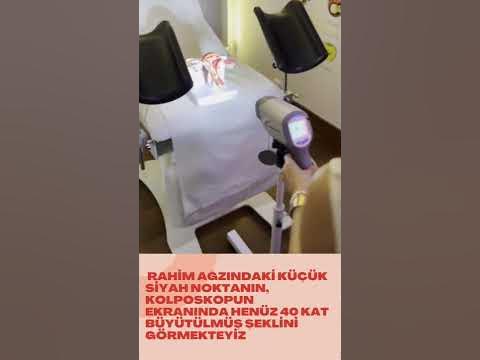 Kolposkopi - YouTube
