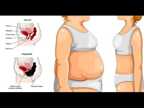 Ejercicios para abdominales en la cama