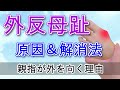 【外反母趾】原因＆解消法 親指が外側に引っ張られる理由