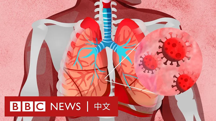 肺炎疫情：新冠病毒如何影响我们的身体？－ BBC News 中文 - 天天要闻