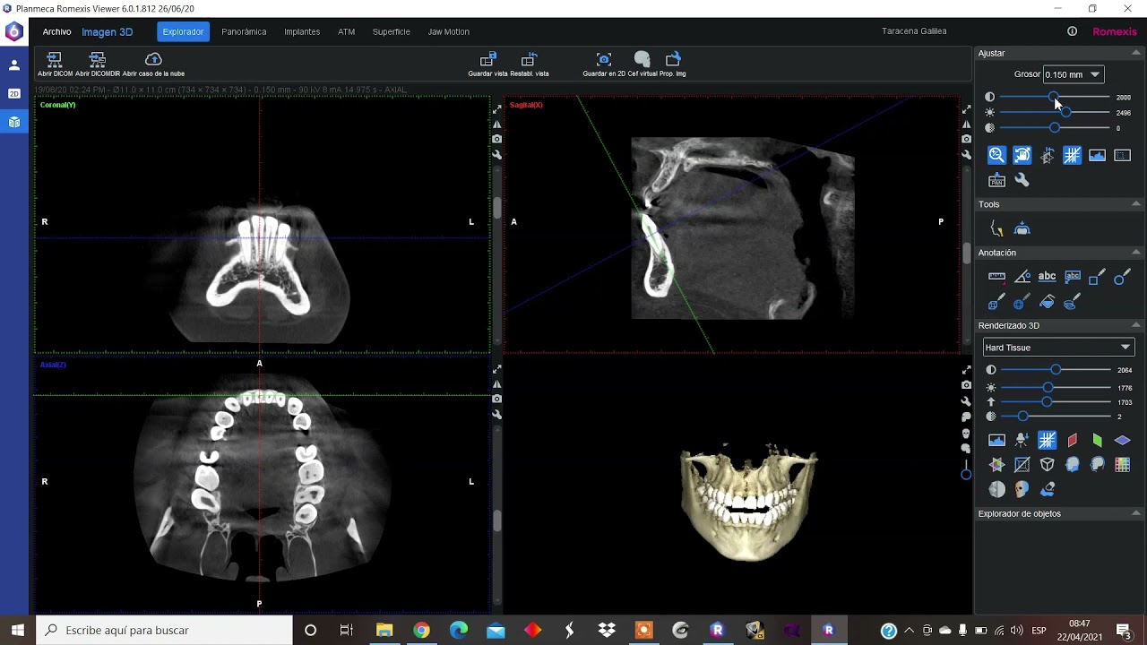 Curso software romexis Centro Radiologico Maxilar