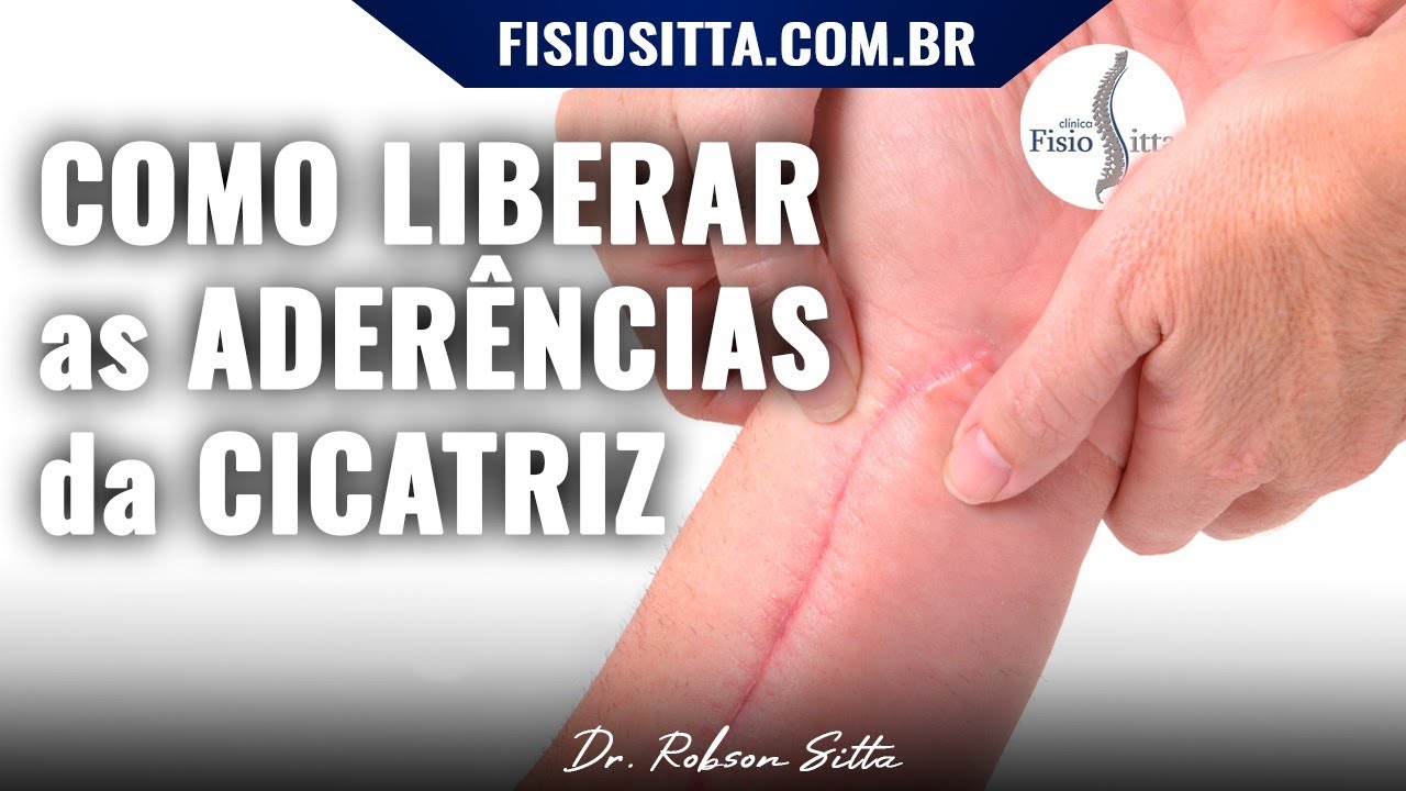 ADERÊNCIA CICATRICIAL MASSAGEM de LIBERAÇÃO PÓS CIRÚRGICA do JOELHO ...