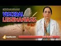 Visceral Leishmaniasis | Leishmania Donovani Disease | Medicine Lectures | V-Learning