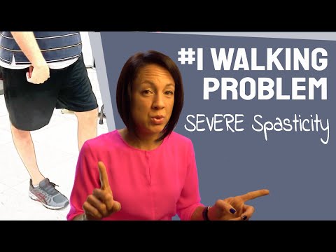 Fix a stiff leg: How to treat severe spasticity