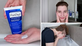 How to use PanOxyl 10% Benzoyl Peroxide Acne Foaming Wash