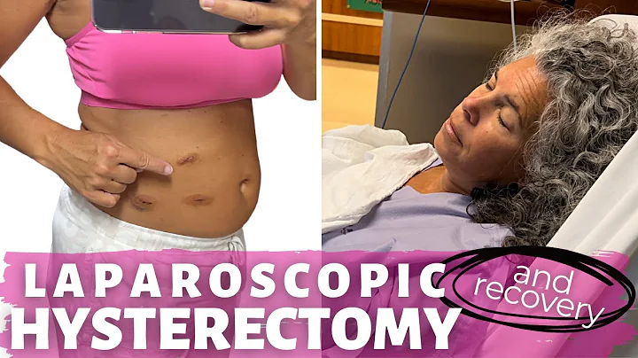 My Laparoscopic Hysterectomy Story & Recovery | Surgical Menopause What to Expect - DayDayNews