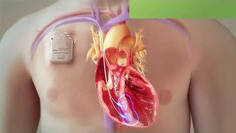 An Overview of CCM Therapy for Medical Professionals (English w CE Mark Indications)