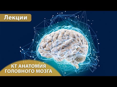 КТ анатомия головного мозга. Андрей Мангов