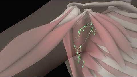 Axillary Anatomy: 3D Animation of Axillary Lymph Node Dissection  Procedure Part - 1