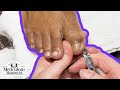 👣How to Fix Big Toenails &amp; Pinky Nails Pedicure Tutorial👣