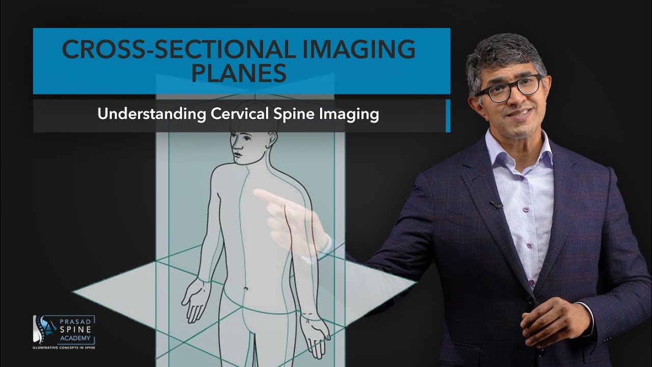 Cross Sectional Imaging Planes ( For CT Scans and MRI) YouTube