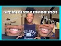 Braces Q&amp;A/ Everything you NEED to know about BRACES