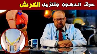 مشروب يساعد فى حرق الدهون وتنزيل الكرش  | دكتور جودة محمد عواد