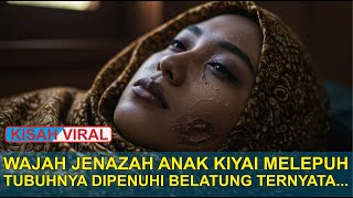 Download Lagu Wajah Jenazah Anak Kiyai Mel3puh Dan Tubuhnya Penuh Bel4tun9 MP3 Download Lagu Wajah Jenazah Anak Kiyai Mel3puh Dan Tubuhnya Penuh Bel4tun9 MP3