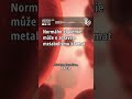 NORMÁLNÍ GLYKÉMIE NEZNAMENÁ ZDRAVÝ METABOLISMUS #Shorts