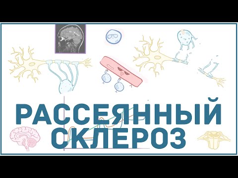 Рассеянный склероз - причины, симптомы, диагностика, лечение