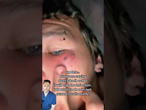 Piercing gone wrong 😳