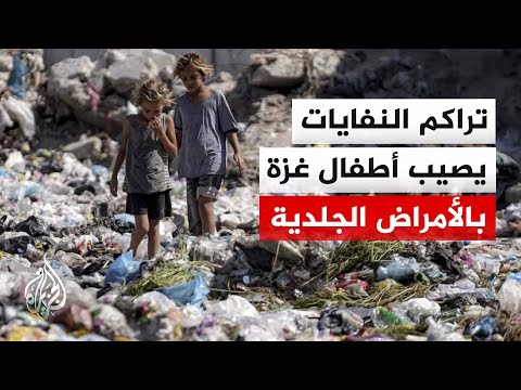 غزة.. تراكم النفايات بمناطق النزوح يساعد في انتشار الأمراض الجلدية