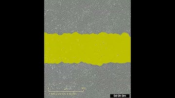 In vitro scratch wound healing assay