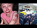 10-year-old girl with special needs ‘brutally’ bitten on school bus, parents say