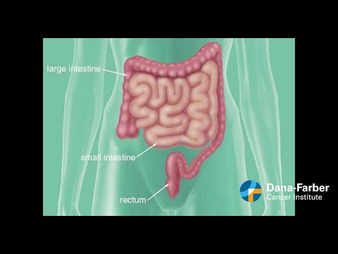 Video: 3 moduri de a detecta cancerul rectal