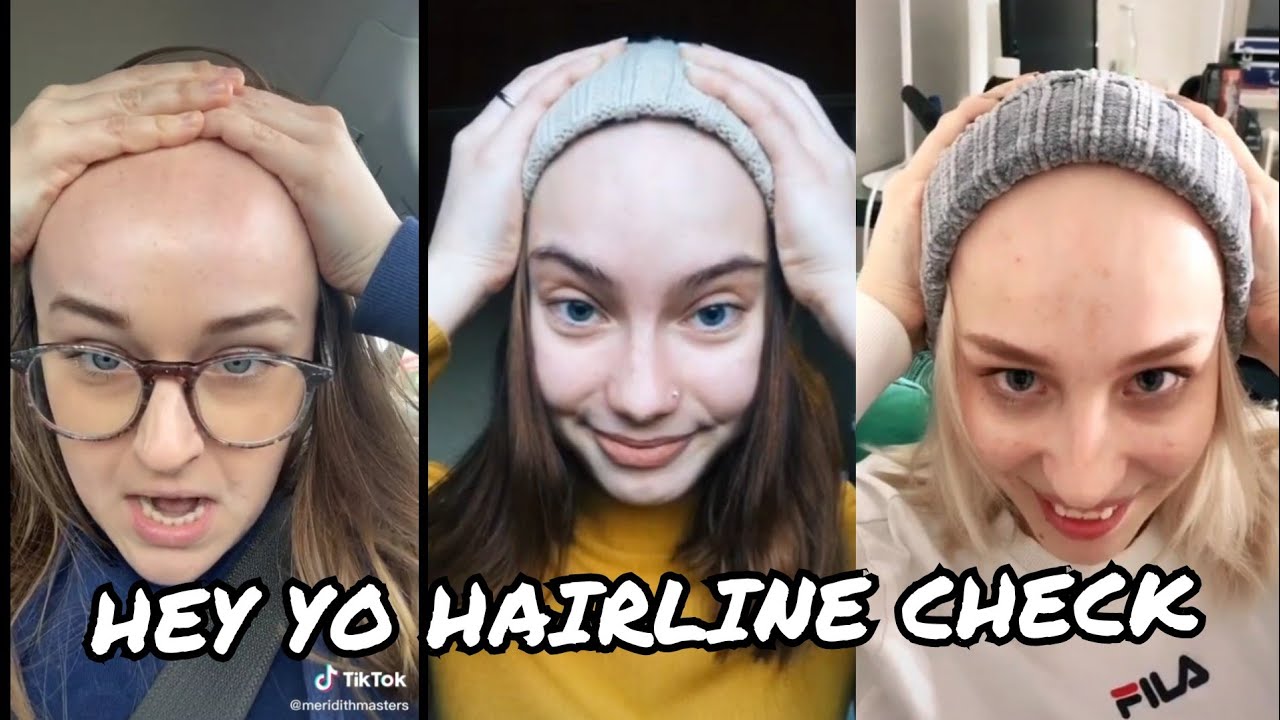 HEY YO HAIRLINE CHECK |Tiktok compilation - YouTube