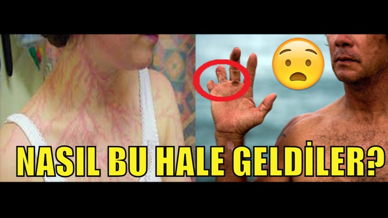 vebahis Betosfer Göndermezsem Ne Olur