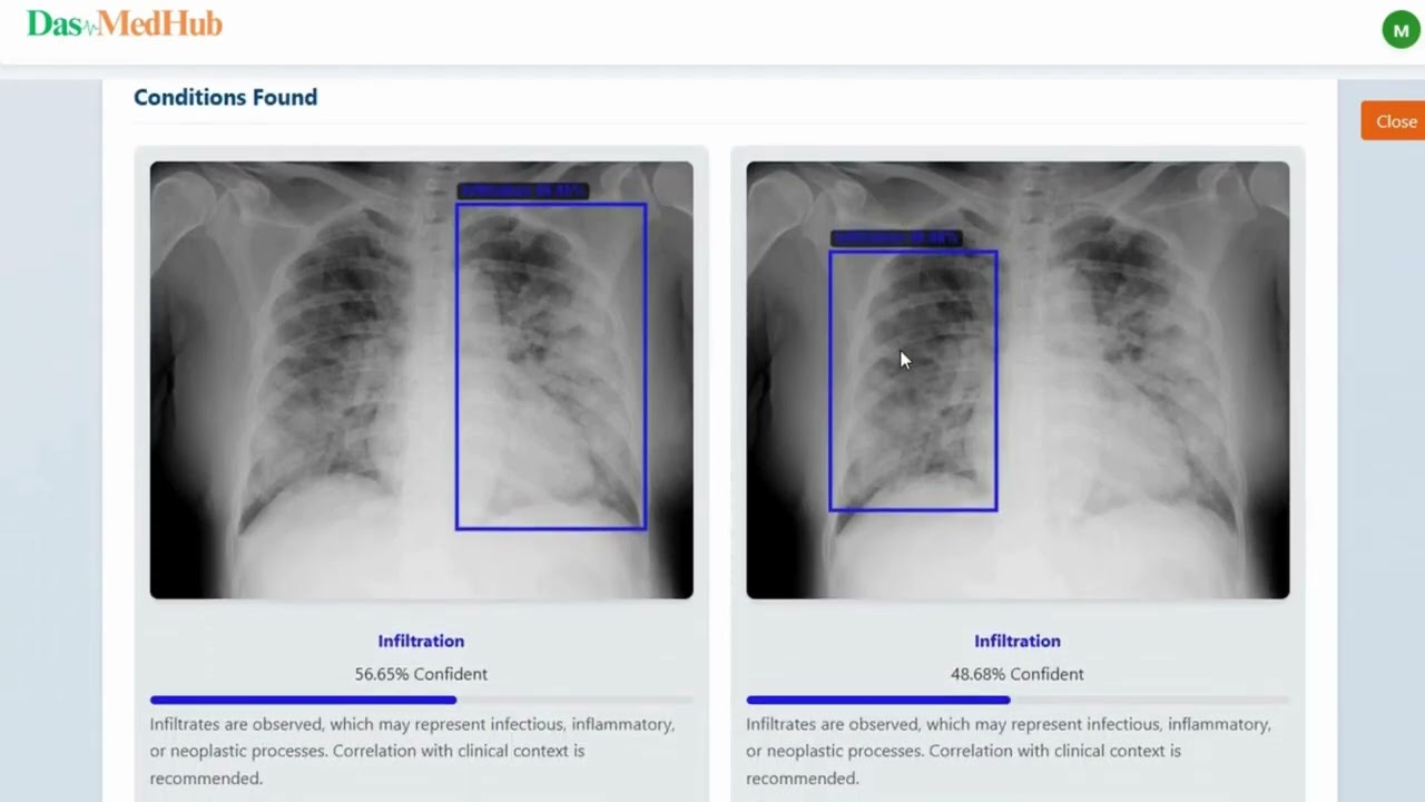 Chest Abnormality Detection