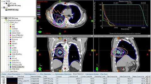 8 Final Dose Review for Lung SBRT