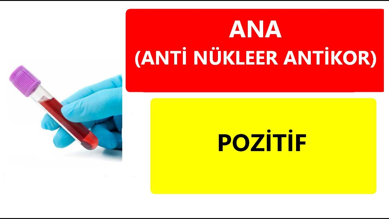 ANA ANT N KLEER ANT KOR POZ T F NE DEMEK YouTube ana-ant-n-kleer-ant-kor-poz-t-f-ne-demek-youtube