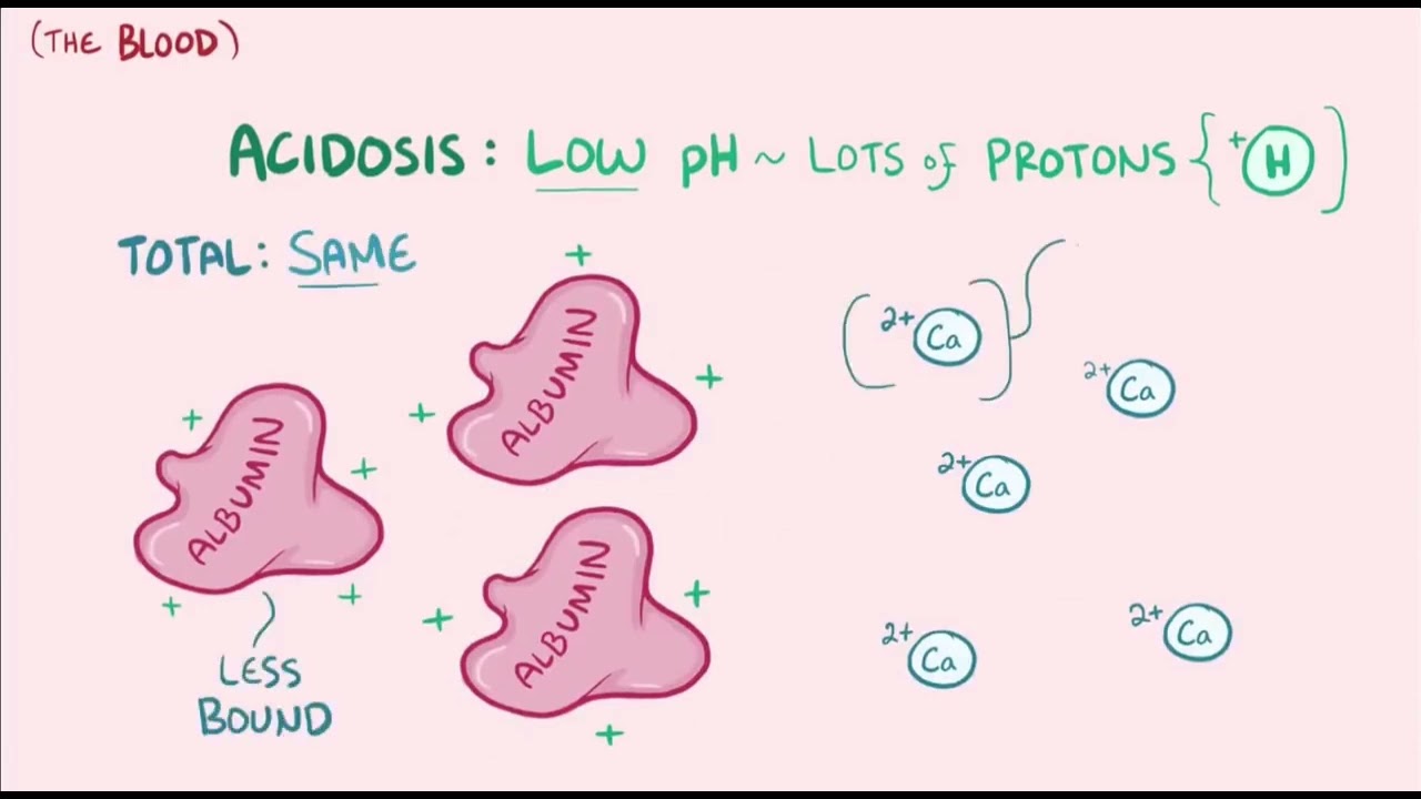 Hypercalcemia - causes | symptoms | diagnosis, treatment | pathology || #Electrolyte #nurse #medical